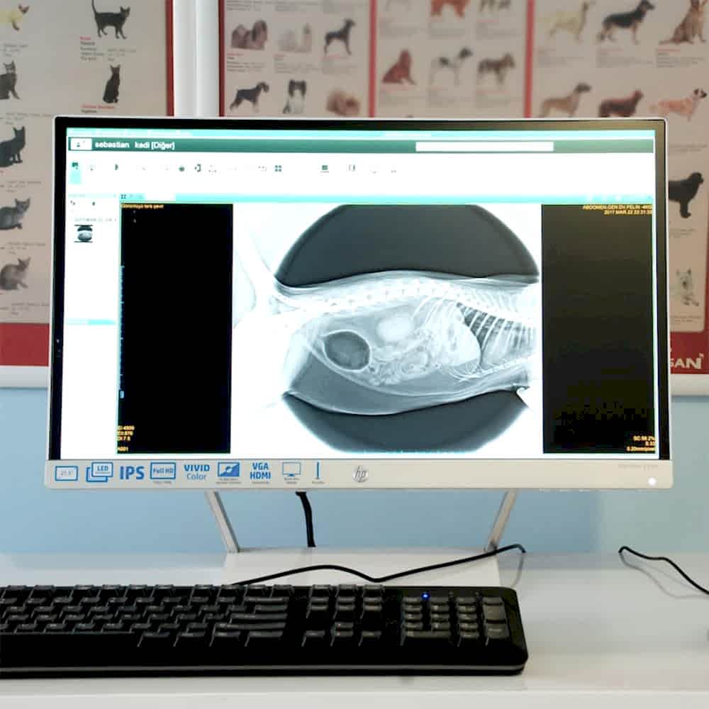 Bilgisayarlı Röntgen (CR)