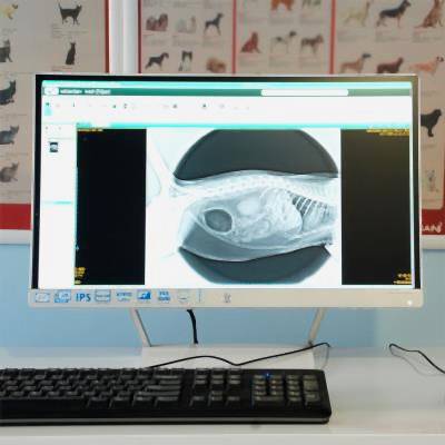 Bilgisayarlı Röntgen (CR)