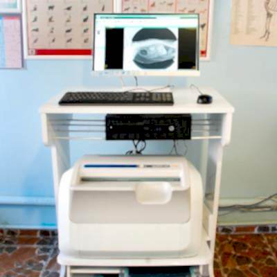 Bilgisayarlı Röntgen (CR)