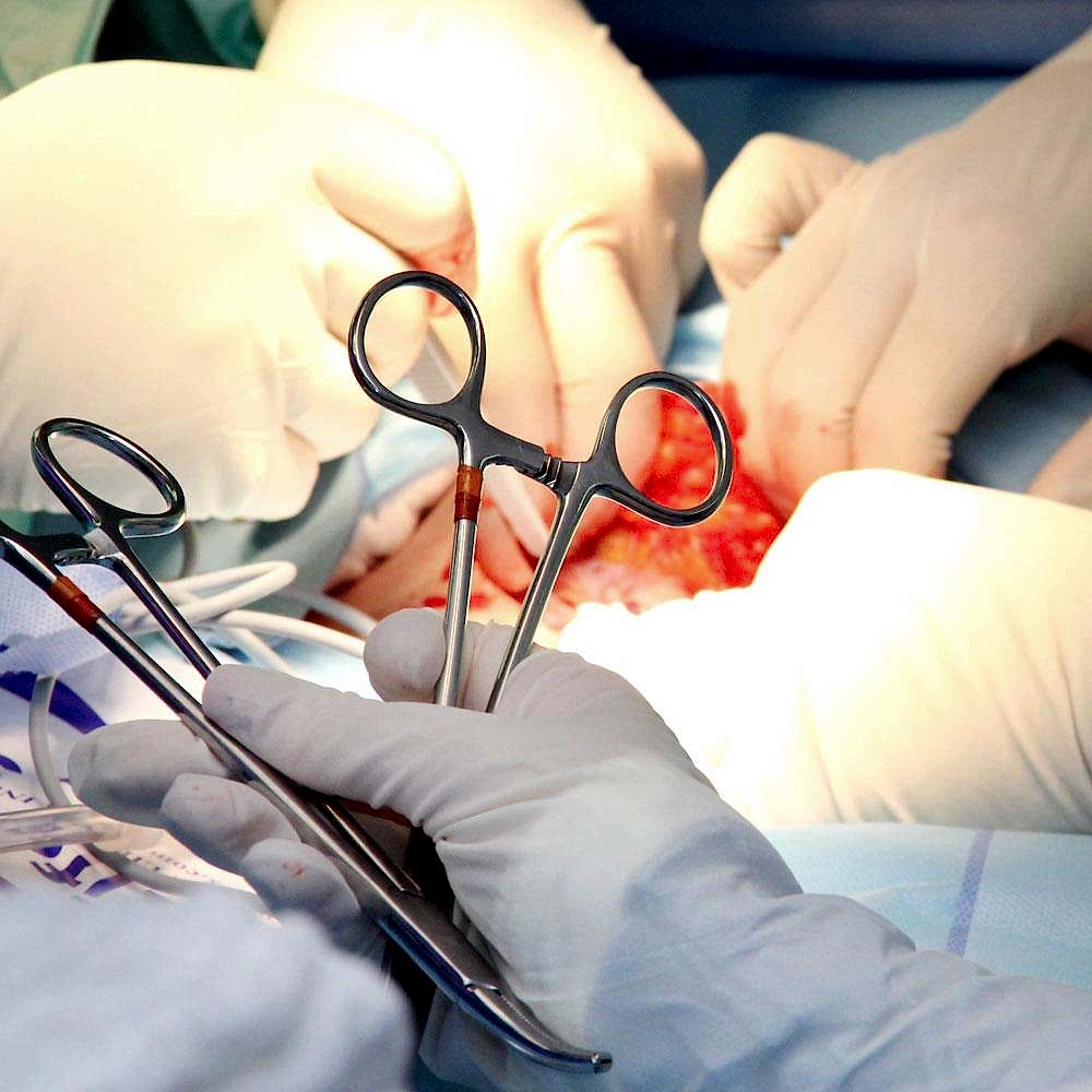 Cerrahi Operasyonlar