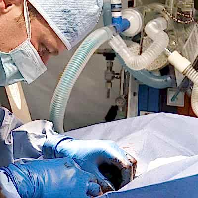 Cerrahi Operasyonlar