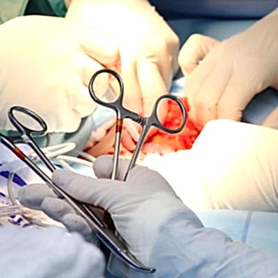 Cerrahi Operasyonlar